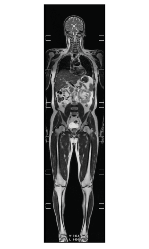 Full Body MRI with high resolution that runs on fiber optics Biology Diagrams